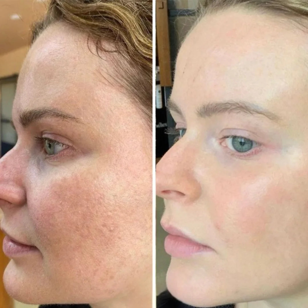 Antes e depois 7
