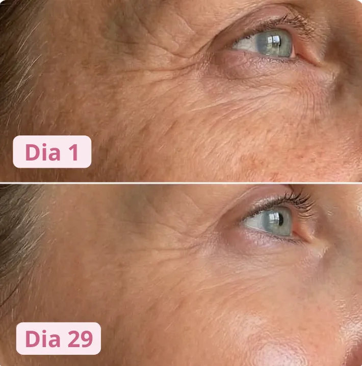 Região dos olhos no dia 1 e no dia 29 de uso